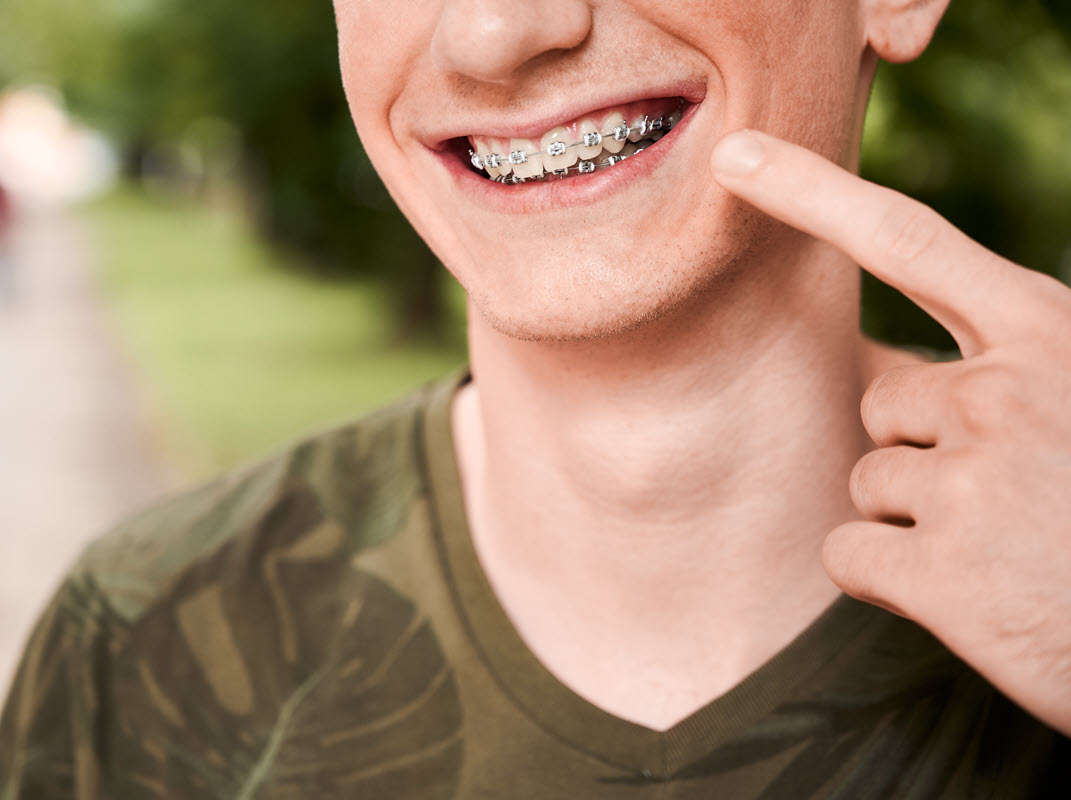 Orthodontics and Aligners